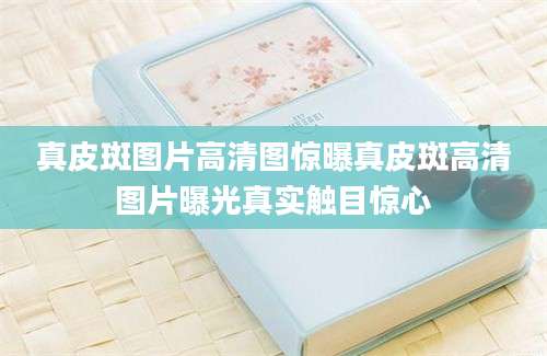 真皮斑图片高清图惊曝真皮斑高清图片曝光真实触目惊心